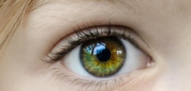 8 أسباب شائعة لالتهاب العين
