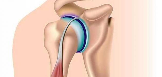 أسباب التهاب أربطة العضلات