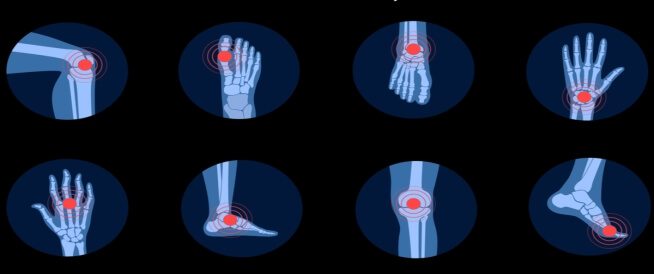 أسباب وجع مفاصل اليدين والرجلين