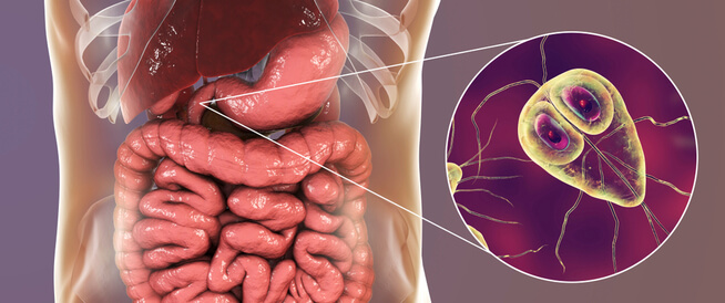 أعراض الجيارديا تعرف عليها
