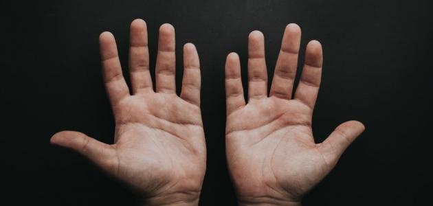 أعراض حساسية اليدين