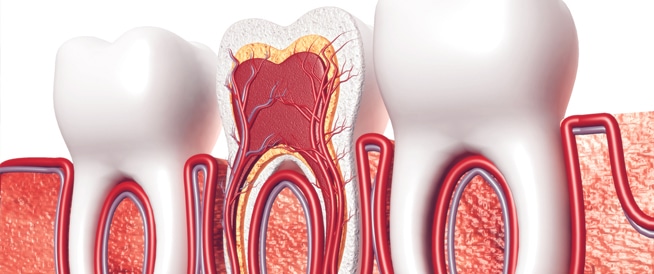 إليك أبرز الأسئلة الشائعة حول علاج قناة الجذر وإجابتها