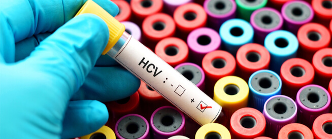 اختبار HCV دليلك الشامل