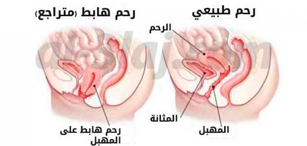 اسباب نزول الرحم