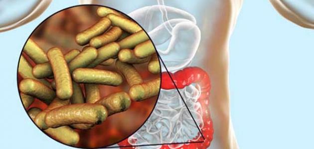 العدوى البكتيرية في الجهاز الهضمي