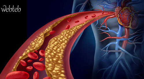 الكولسترول السيء وعوامل الخطورة الاخرى لتصلب الشرايين