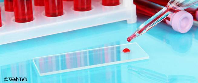 انخفاض تعداد خلايا الدم الآثار الجانبية لعلاج السرطان