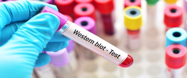 تحليل Western blot