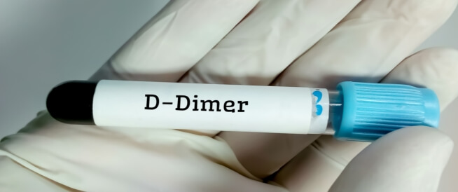 تحليل d dimer المعدل الطبيعي