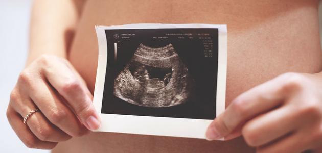 تكوين الجنين في الشهر الخامس
