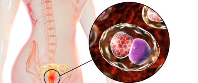 جرثومة الرحم تعرف عليها من قرب