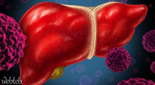 سرطان الكبد انعكاس لعدد من الأمراض الصحية المنتشرة في مصر