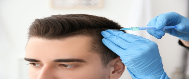 شروط زراعة الشعر إليكم أبرزها