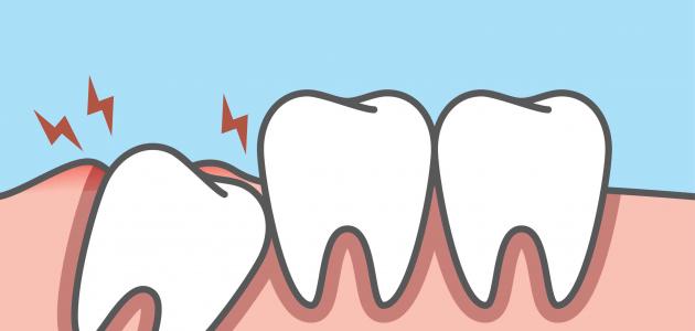 طرق علاج الضرس الملتهب