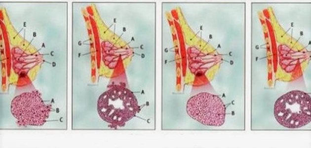 طريقة انتشار سرطان الثدي لباقي الجسم