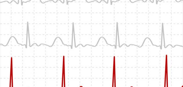 طريقة قراءة تخطيط القلب