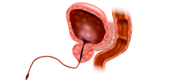 علاج التهاب الإحليل ومضاعفات إهماله