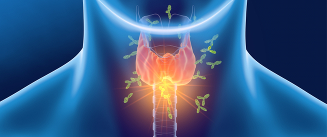 علاج التهاب الغدة الدرقية المناعي