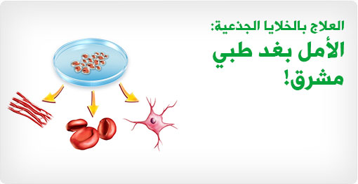 علاج بالخلايا الجذعية الأمل بغد طبي مشرق