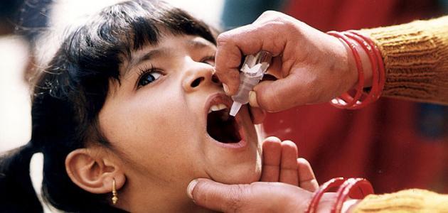 علاج مرض شلل الاطفال
