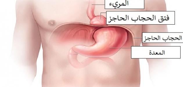 فتق الحجاب الحاجز و أنواعه