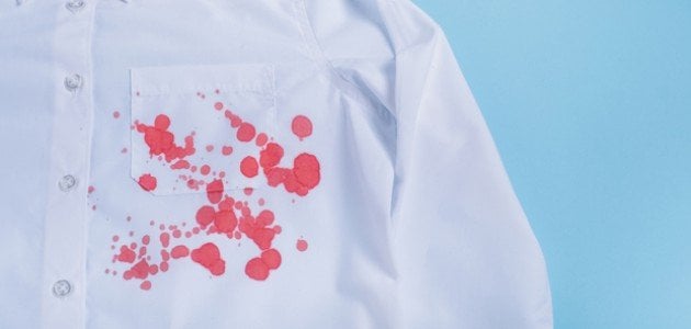 كيفية إزالة بقع الدم القديمة من الملابس