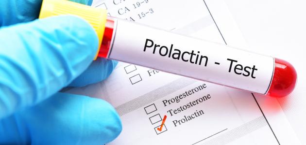 ما هو تحليل Prolactin