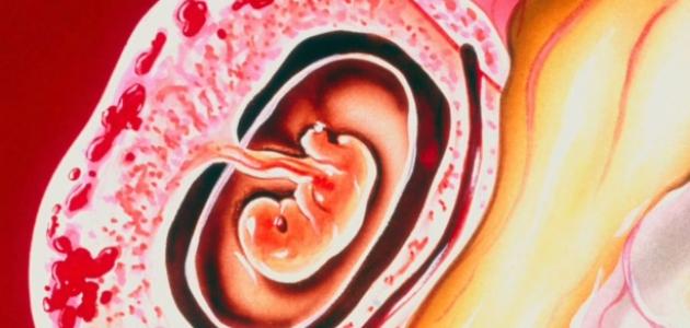 ما هو علاج الحمل خارج الرحم