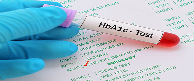 ما هو فحص الهيموغلوبين السكري HBa1c؟