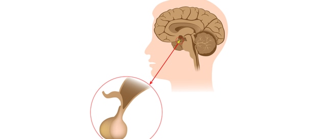 ما هي الغدة النخامية والأمراض المرتبطة بها؟