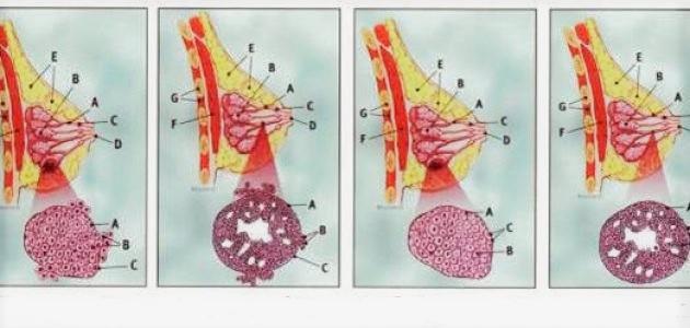 مراحل تطور سرطان الثدي