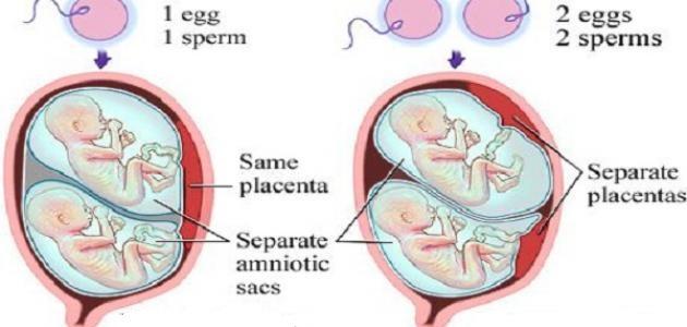 مراحل نمو التوائم في بطن الأم